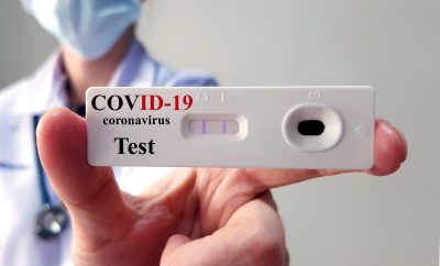 covid test px1r 400x242 - Россияне по прибытии из-за рубежа обязаны будут сдавать два теста на COVID-19
